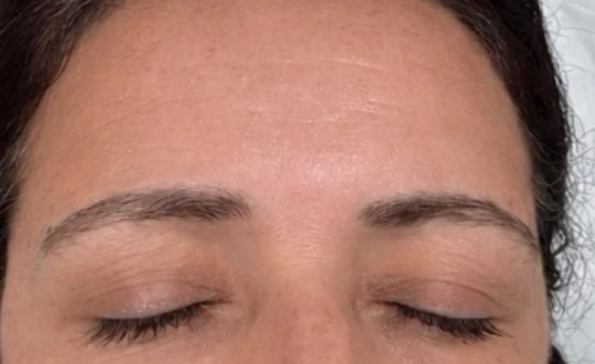 Brow lamination: before and after , before